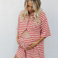 Madeline Set - Beige/Red Stripe